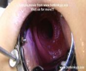 Sexy pirate Xo speculum deep insertion & belly bulge HKJ from pirates porn full