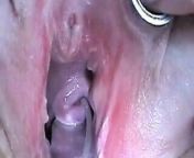 Cum Injection with Syringe in Cervix Uterus after Fucking from stim 99