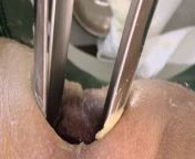 Massive horse speculum, double fisting, doctor, super nurse from indian doctor howsef sex downlod com